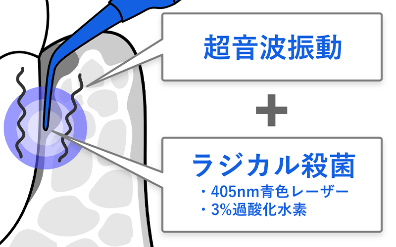 従来の歯周病治療との比較